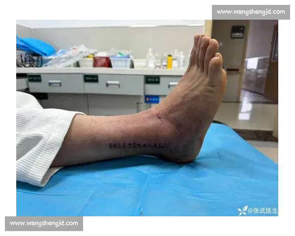 加维周一接受膝盖复查 关节镜手术风险待评估